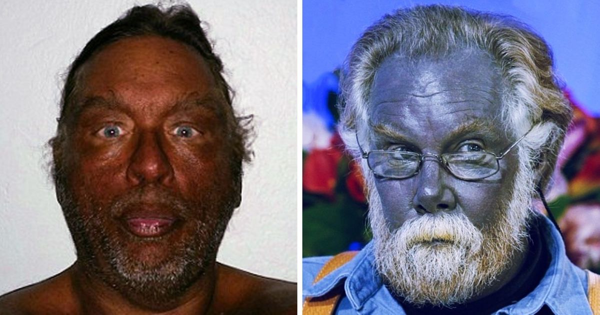 10 Pessoas que foram cobaias de seus próprios experimentos 10 Pessoas que foram cobaias de seus próprios experimentos