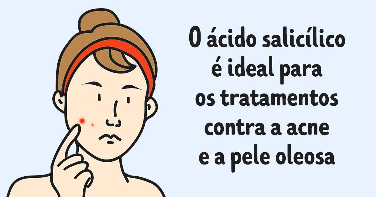 Guia completo dos ácidos utilizados em cosméticos para ajudar você a descobrir o mais indicado para a sua pele