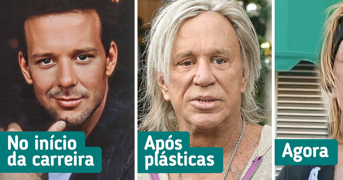 A cirurgia que mudou Mickey Rourke mais do que qualquer papel no cinema A cirurgia que mudou Mickey Rourke mais do que qualquer papel no cinema