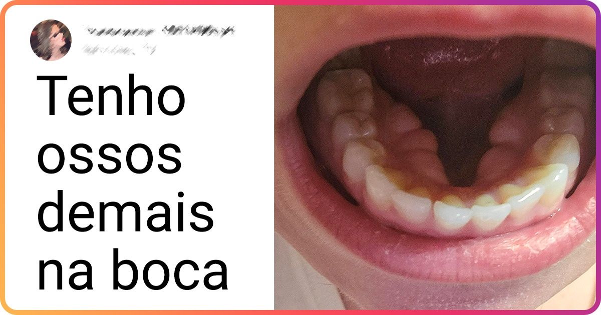 18 Fotografias que mostram o lado “oculto” das coisas