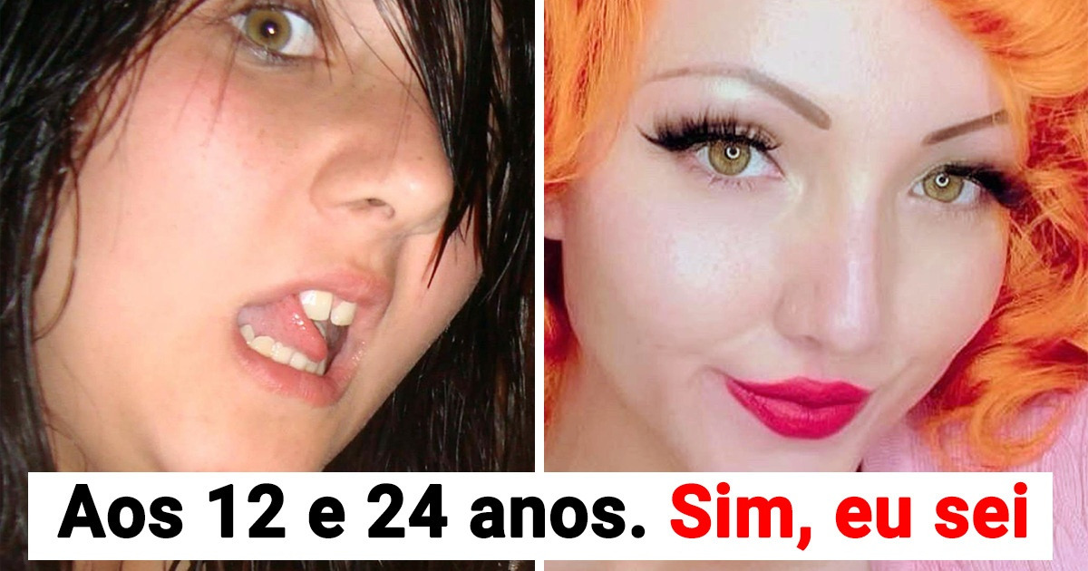 15 Pessoas que passaram por uma metamorfose ao longo dos anos e agora estão no auge da beleza
