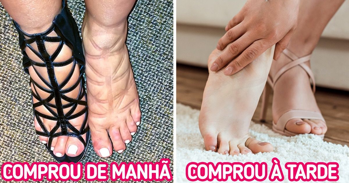 5 Erros comuns que algumas pessoas cometem na hora de escolher sapatos e que podem acometer a saúde 5 Erros comuns que algumas pessoas cometem na hora de escolher sapatos e que podem acometer a saúde