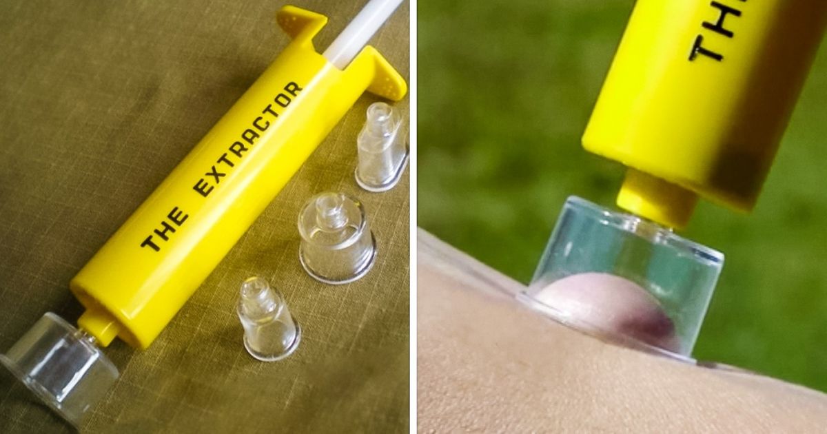 9 dispositivos que podem salvar sua vida numa emergência