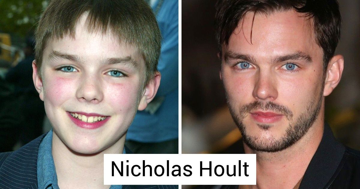 18 Famosos que passaram de “patinhos feios” a “belos cisnes” 18 Famosos que passaram de “patinhos feios” a “belos cisnes”