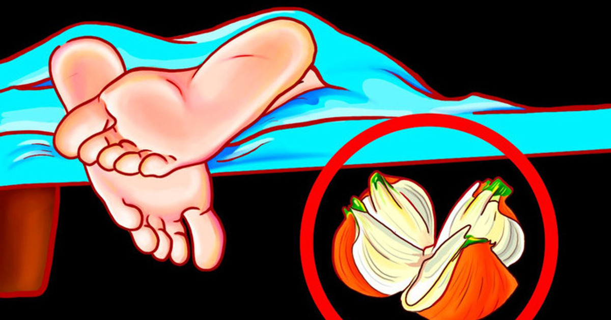 Deixe Uma Cebola Debaixo Da Cama Por Uma Noite — Você Terá Uma Surpresa Quando Acordar Deixe Uma Cebola Debaixo Da Cama Por Uma Noite — Você Terá Uma Surpresa Quando Acordar