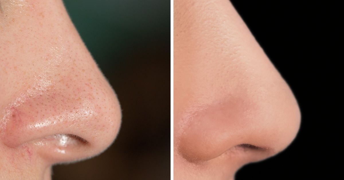 10 Máscaras caseiras com resultados tão bons quanto as feitas por esteticistas profissionais
