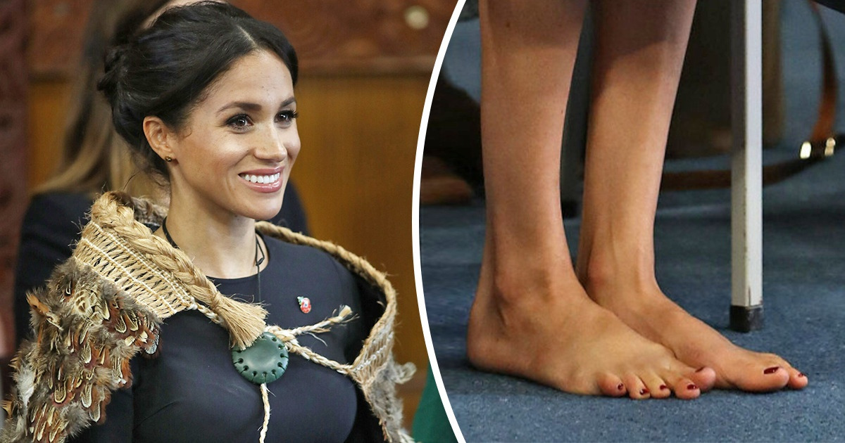 9 "Defeitos" que você pode deixar de reparar no espelho e viver sem se preocupar