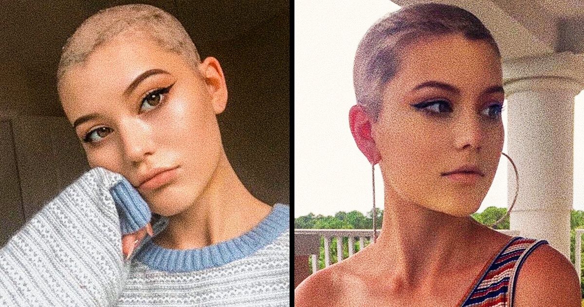 A doença que faz a pessoa ter obsessão por arrancar os cabelos