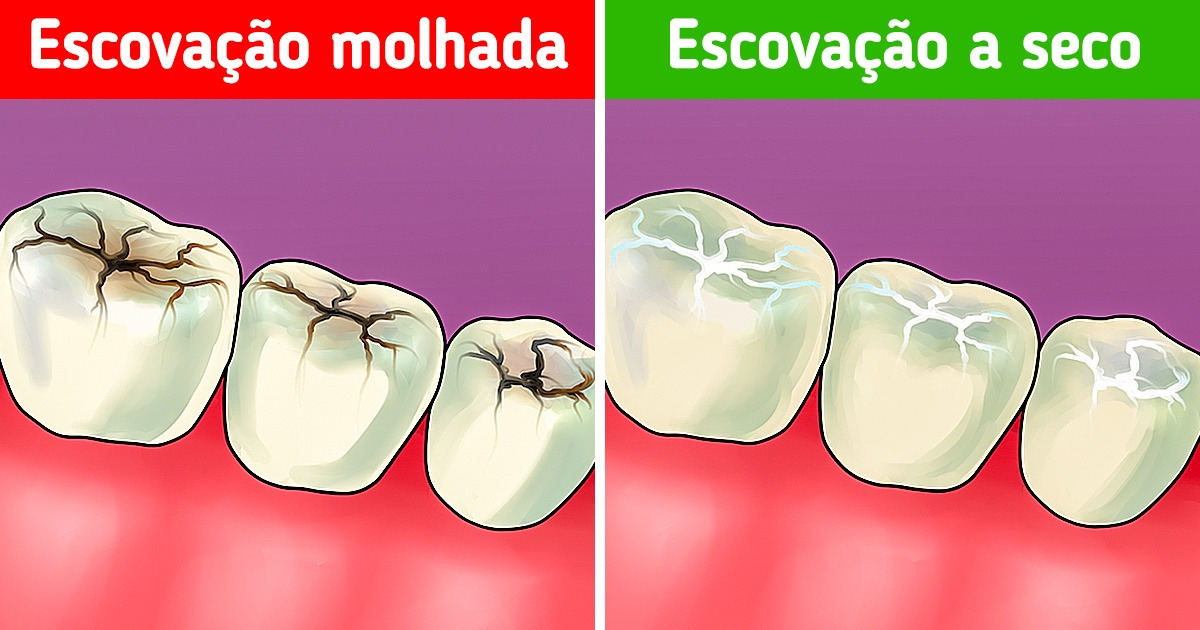 9 Dicas de cuidados dentários que talvez você desconheça