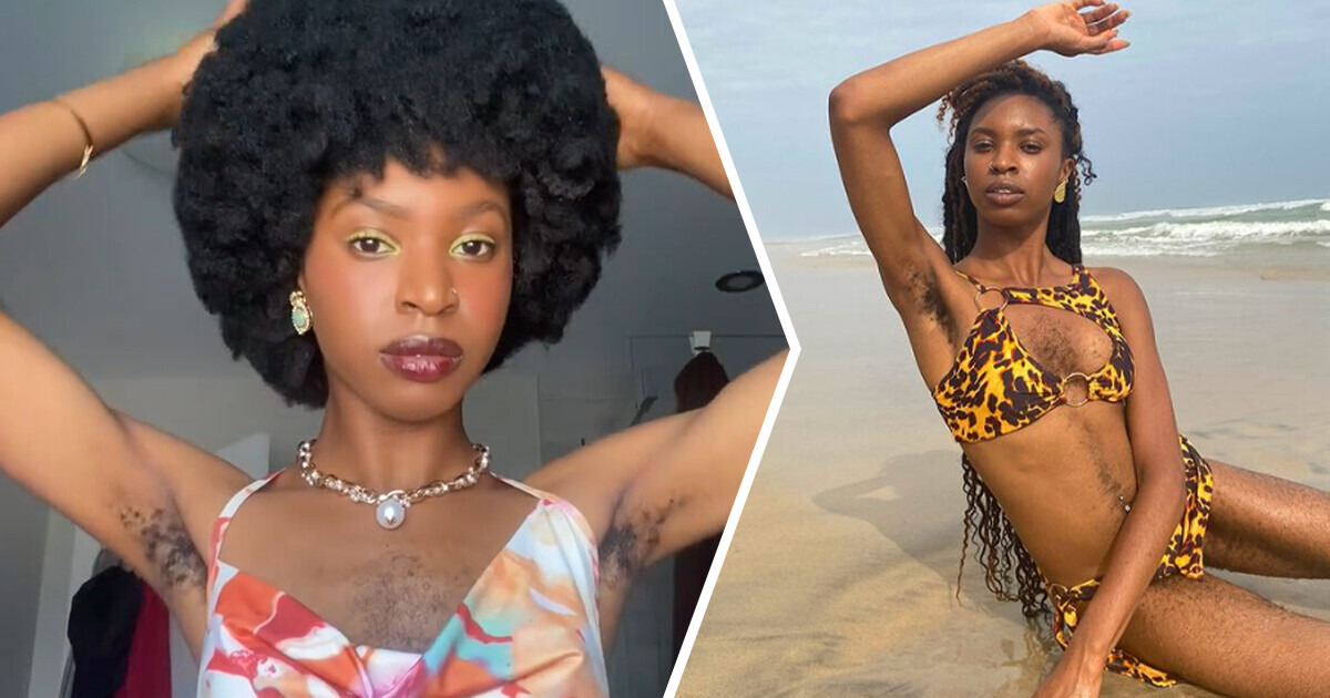 Mulher desafia padrões ao afirmar que os pelos corporais não são motivo de vergonha Mulher desafia padrões ao afirmar que os pelos corporais não são motivo de vergonha