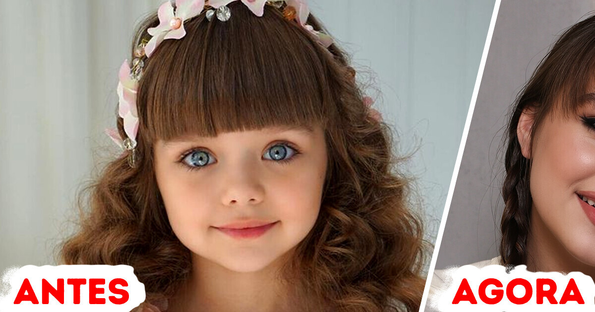 A “menina mais bonita do mundo” cresceu e sua evolução impressiona