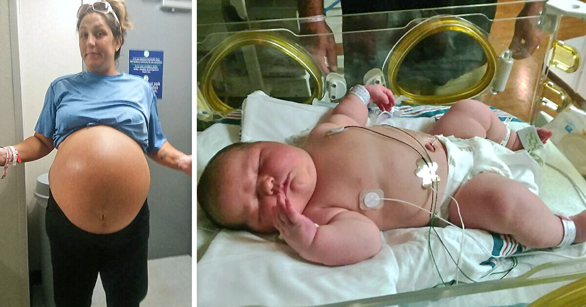 Mulher dá à luz um bebê de seis quilos, e as fotos chocam a internet Mulher dá à luz um bebê de seis quilos, e as fotos chocam a internet