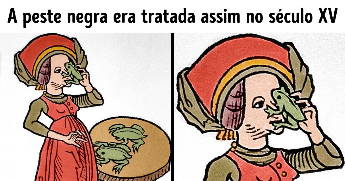 7 Tratamentos da medicina usados no passado que hoje dão calafrios 7 Tratamentos da medicina usados no passado que hoje dão calafrios