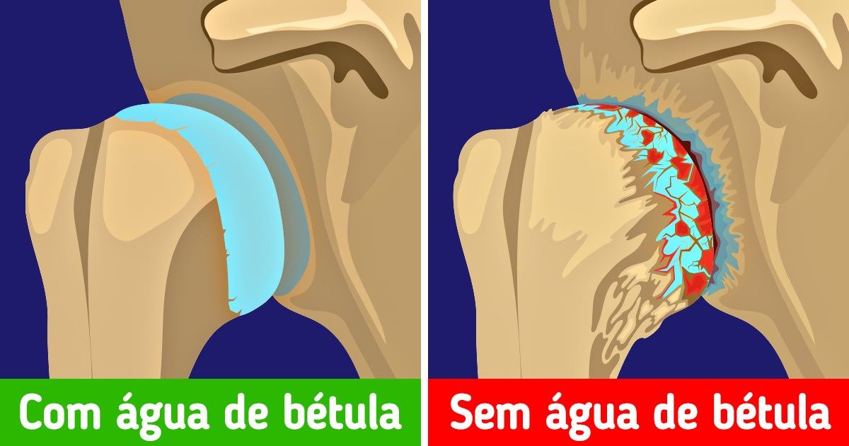 10 Bebidas que podem fazer maravilhas para a sua saúde 10 Bebidas que podem fazer maravilhas para a sua saúde