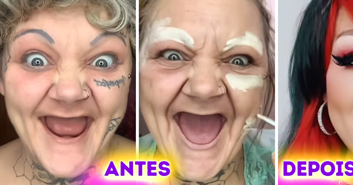 Intolerante a laticínios, ela perdeu os dentes aos 38 anos, mas sua transformação é admirável