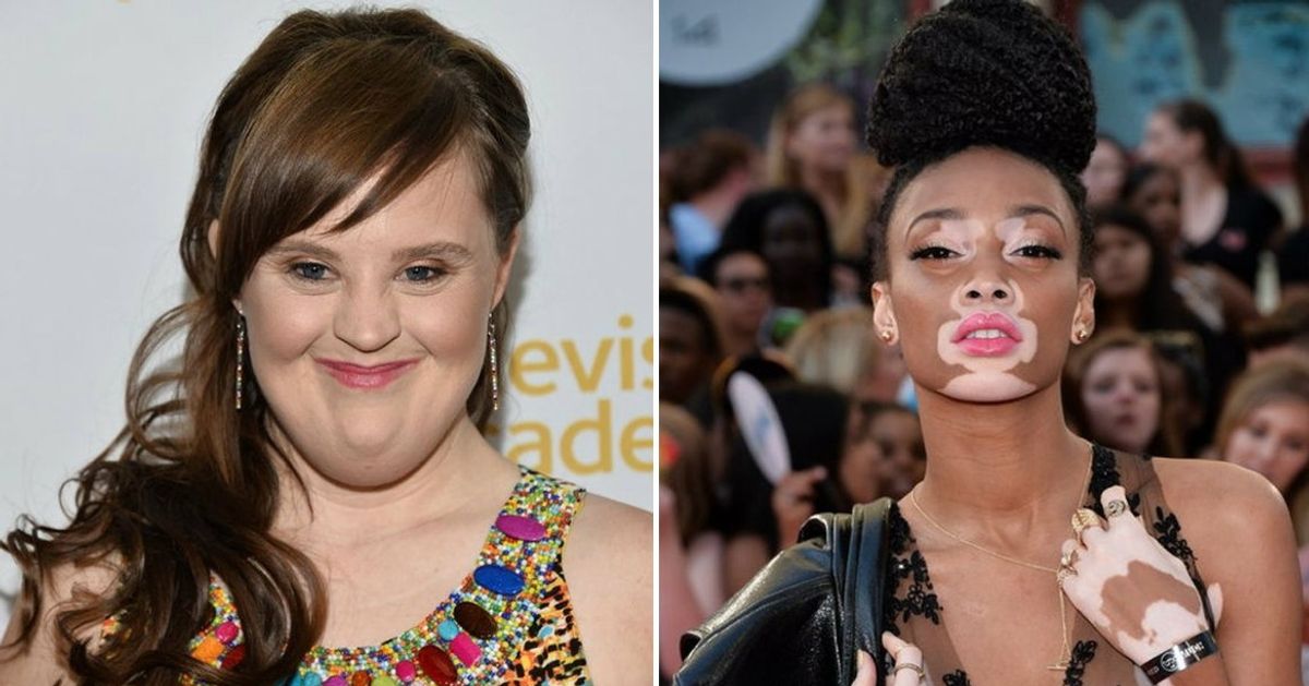 10 Mulheres que mostraram que a beleza não tem limites