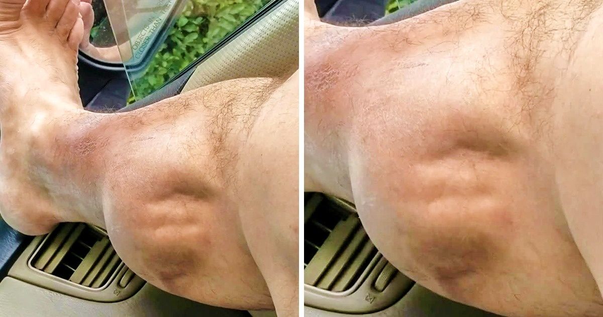 12 Maneiras de se livrar das cãibras 12 Maneiras de se livrar das cãibras