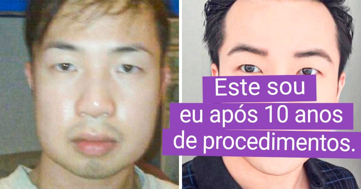 20 Pessoas que escolheram a felicidade, optaram pela cirurgia plástica e se deram bem