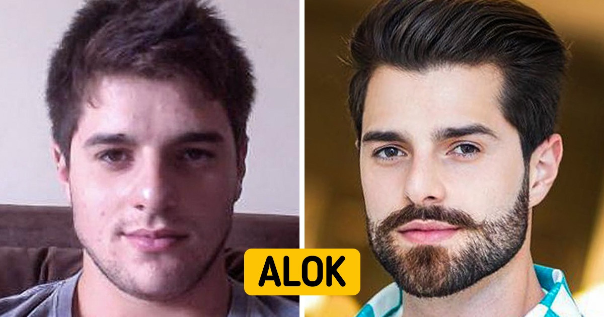 19 Antes e depois dos famosos brasileiros que mudaram bastante em 10 anos 19 Antes e depois dos famosos brasileiros que mudaram bastante em 10 anos