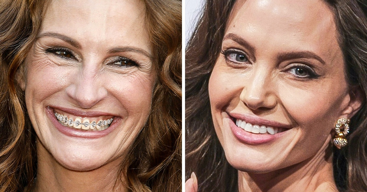 Como ficariam 14 estrelas sem o famoso sorriso perfeito de Hollywood