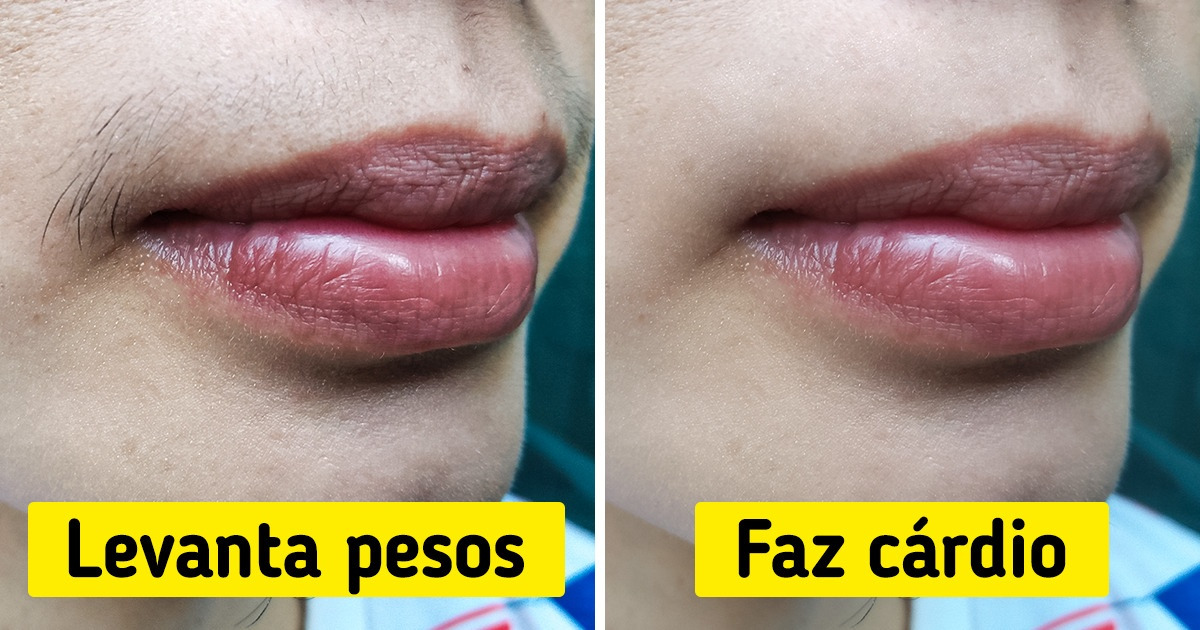 6 Maneiras de prevenir naturalmente o crescimento de pelos faciais 6 Maneiras de prevenir naturalmente o crescimento de pelos faciais