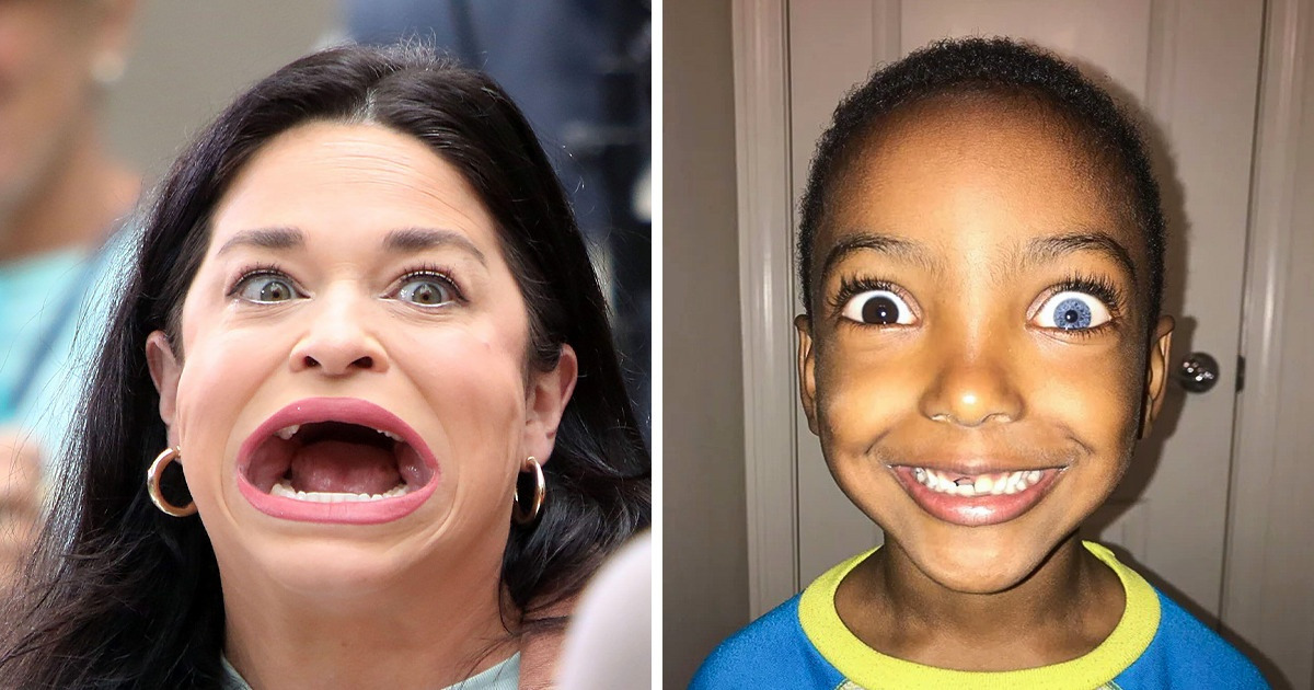 15+ Excentricidades anatômicas que hipnotizam os curiosos de plantão