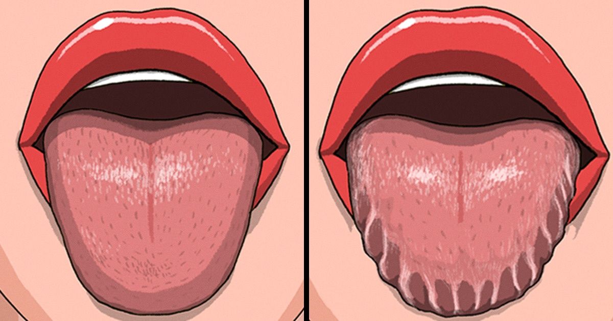 10 Mudanças no seu corpo que podem revelar muito sobre a sua saúde