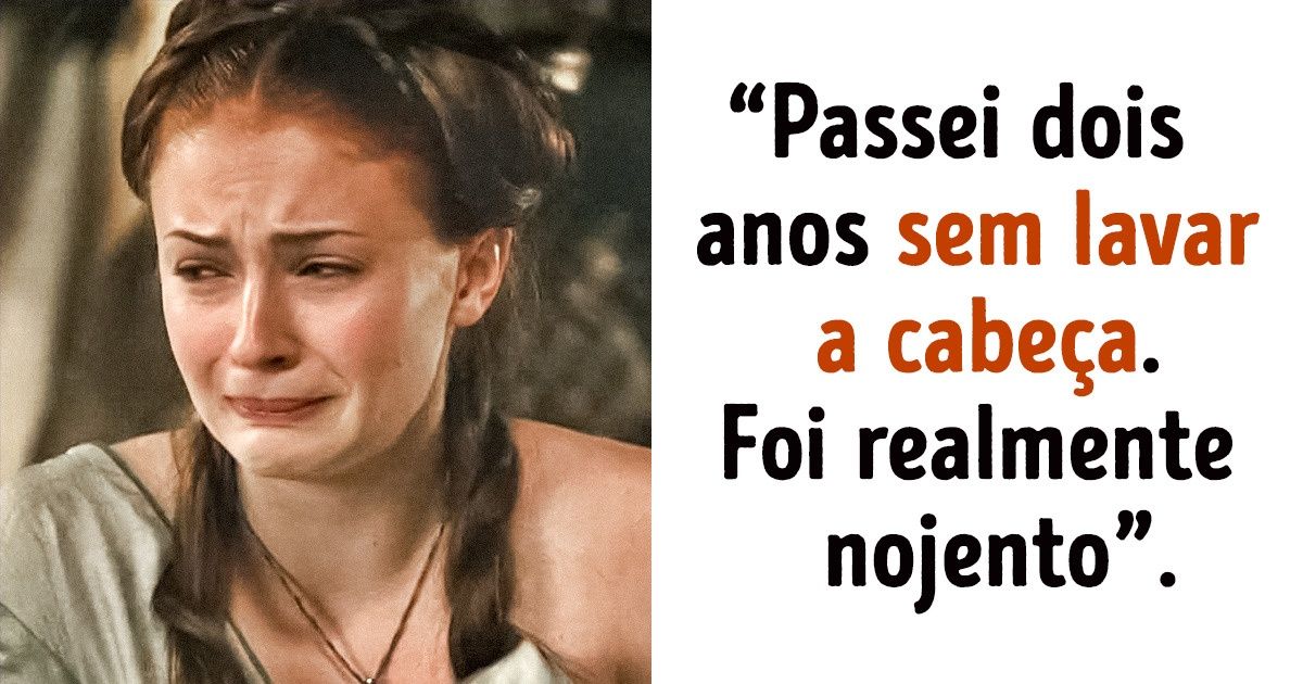 10 Momentos pouco agradáveis vivenciados por atores de “Game of Thrones” 10 Momentos pouco agradáveis vivenciados por atores de “Game of Thrones”