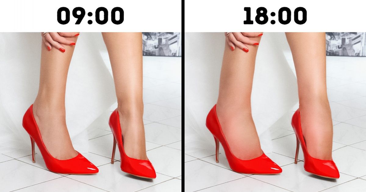 Tudo o que você precisa saber sobre a insuficiência cardíaca