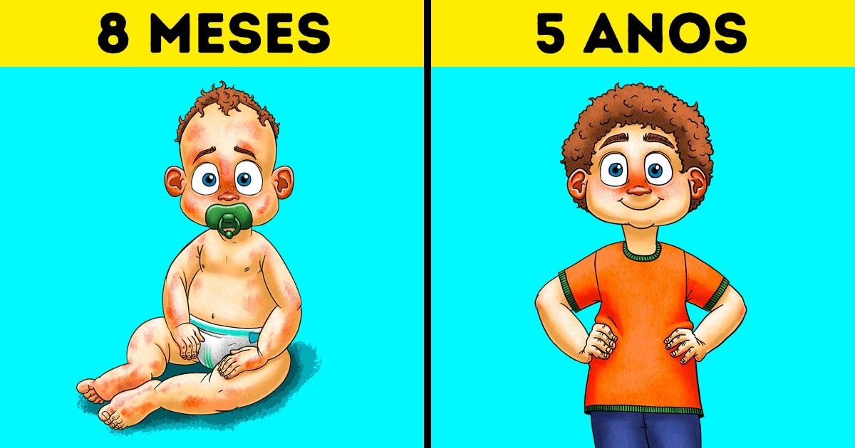 Dicas de pediatras para criar uma criança saudável Dicas de pediatras para criar uma criança saudável