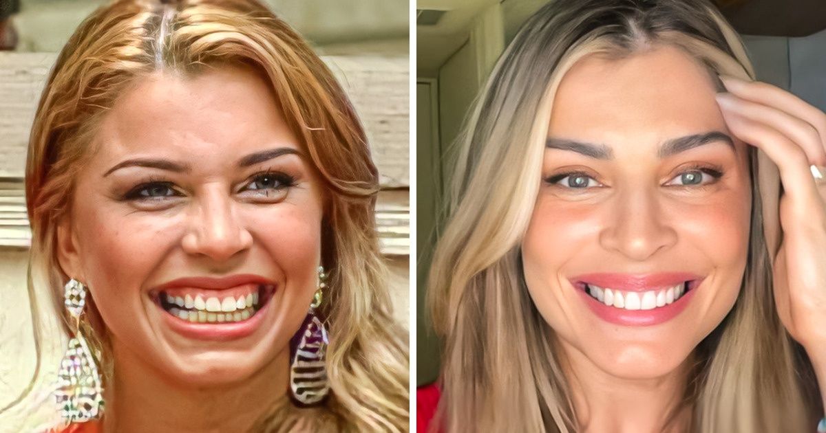 19 Famosos brasileiros que repaginaram os dentes e ganharam sorrisos mais cativantes 19 Famosos brasileiros que repaginaram os dentes e ganharam sorrisos mais cativantes