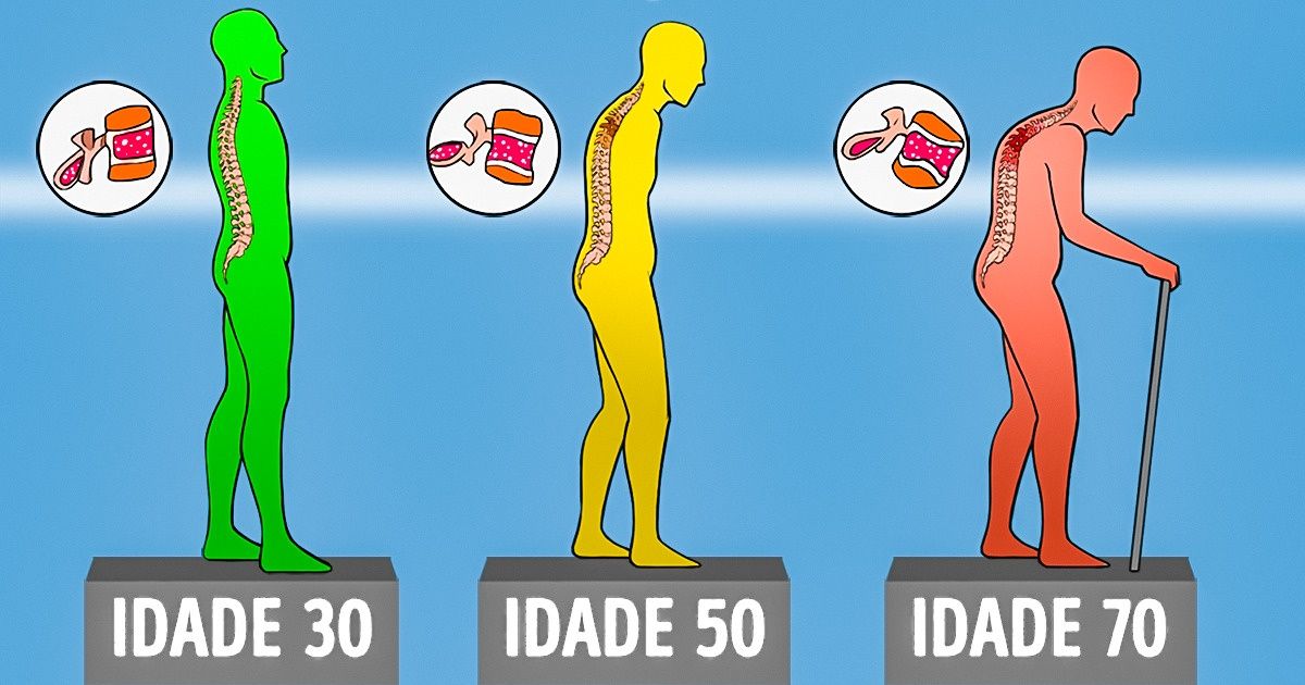 Como manter a saúde dos ossos mesmo com o avanço da idade