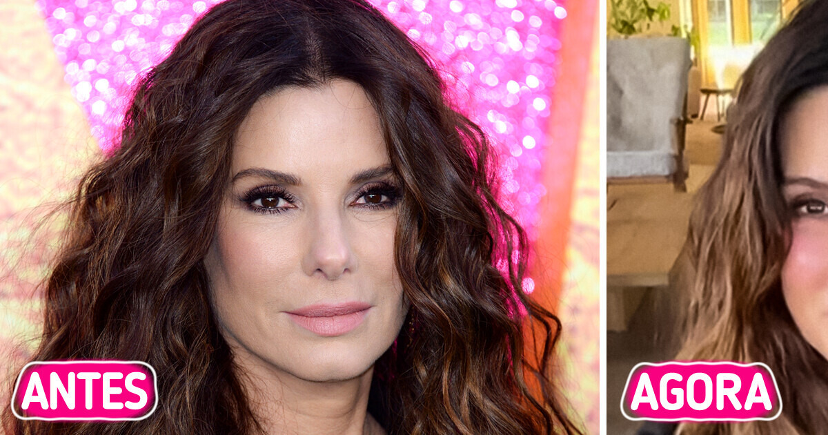 ‘Muito botox’: Sandra Bullock, aos 60, vira assunto por causa de novo vídeo ‘Muito botox’: Sandra Bullock, aos 60, vira assunto por causa de novo vídeo