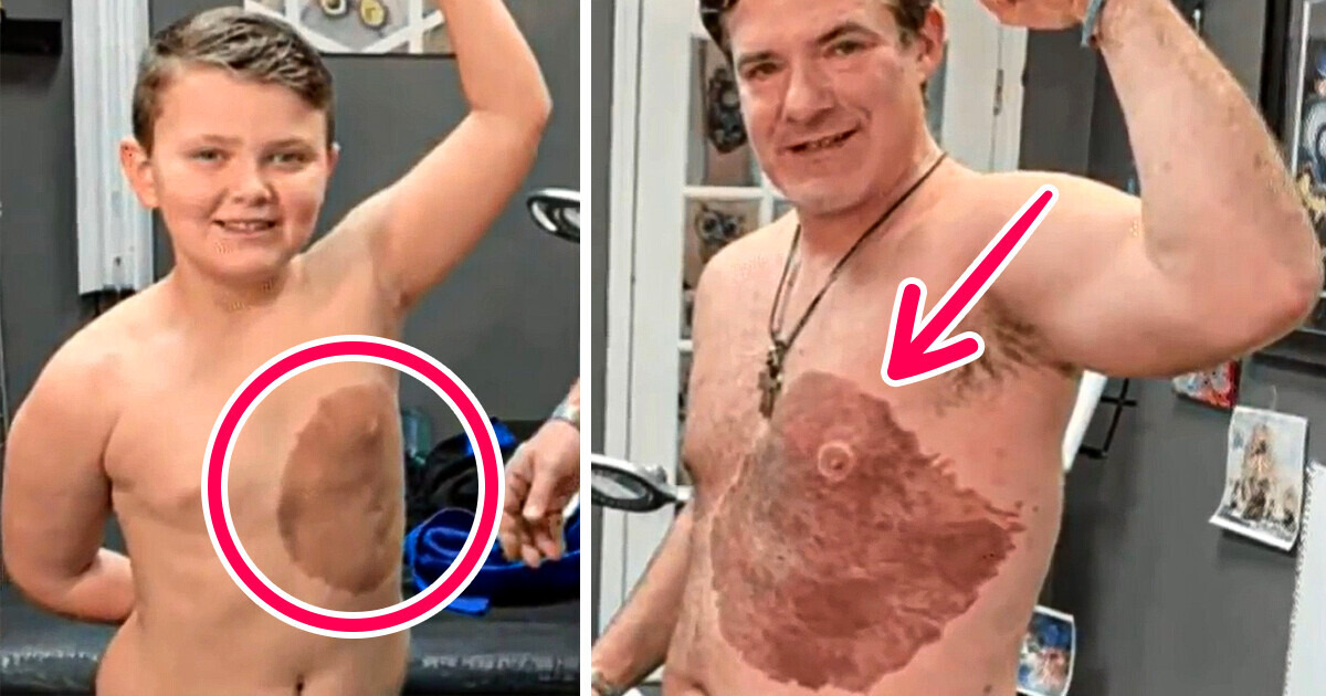 Pai encara 30 HORAS DE DOR para tatuar marca de nascença do filho e acabar com sua vergonha Pai encara 30 HORAS DE DOR para tatuar marca de nascença do filho e acabar com sua vergonha
