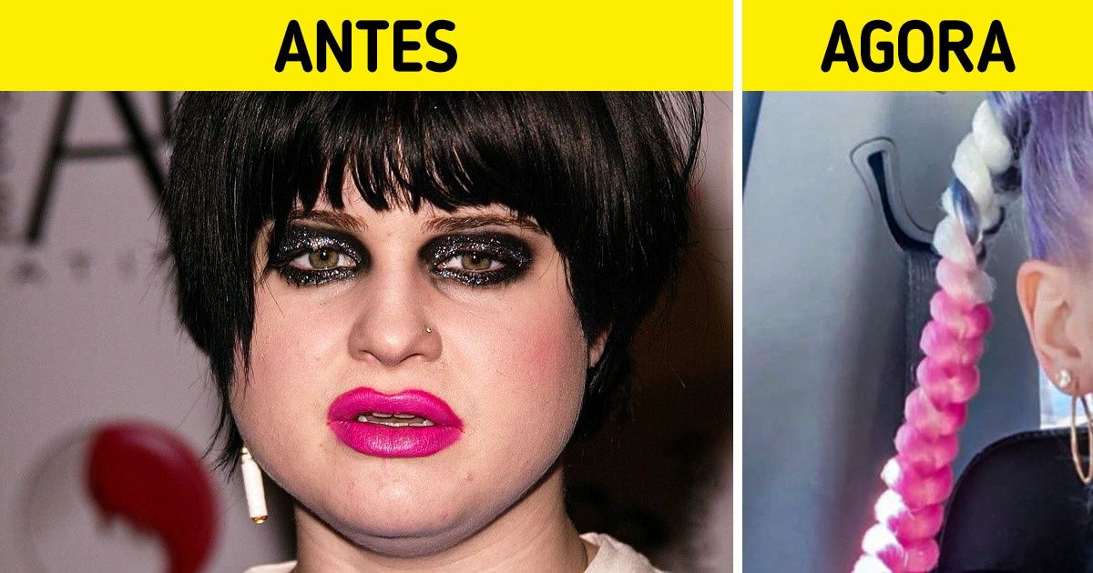 20+ Famosos que passaram por transformações radicais (alguns ficaram surpreendentes) 20+ Famosos que passaram por transformações radicais (alguns ficaram surpreendentes)