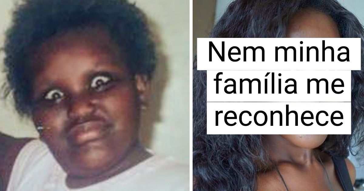 20 Provas de que o tempo pode ser o melhor remédio para a aparência 20 Provas de que o tempo pode ser o melhor remédio para a aparência