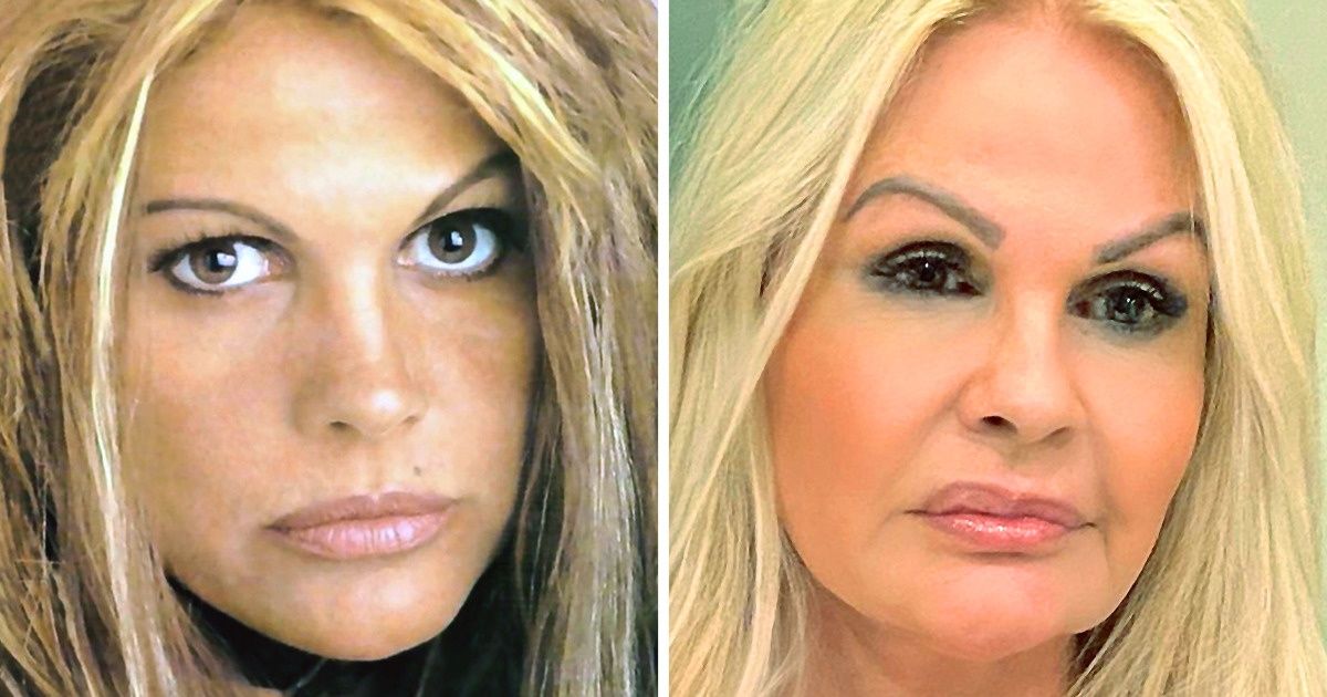 18 Pares de fotos que mostram os efeitos do tempo nos rostos de musas brasileiras 18 Pares de fotos que mostram os efeitos do tempo nos rostos de musas brasileiras