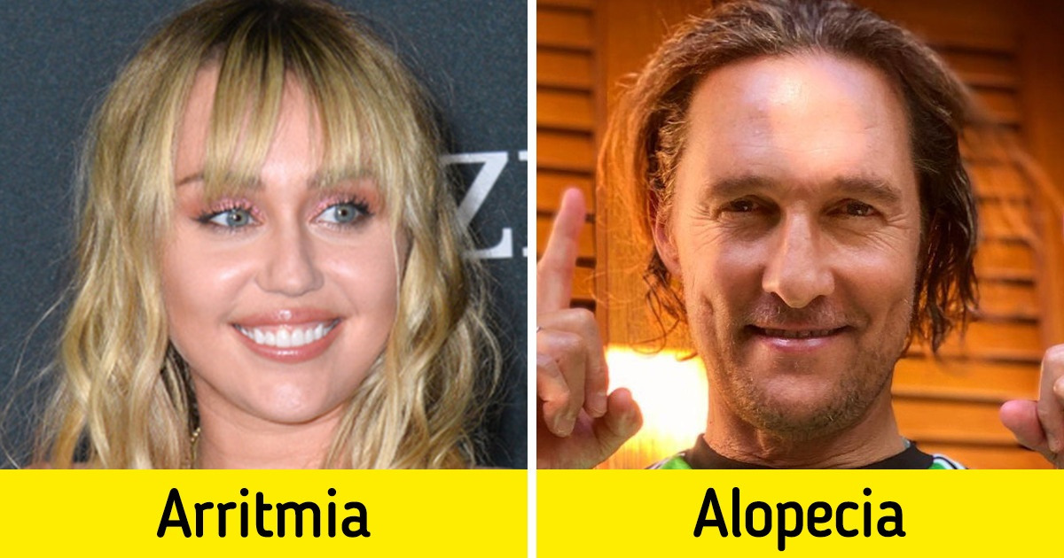 14 Famosos com problemas de saúde que não os impediram de conquistar o sucesso 14 Famosos com problemas de saúde que não os impediram de conquistar o sucesso