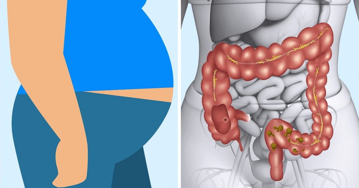 10 Alimentos que ajudam a limpar seu corpo naturalmente 10 Alimentos que ajudam a limpar seu corpo naturalmente
