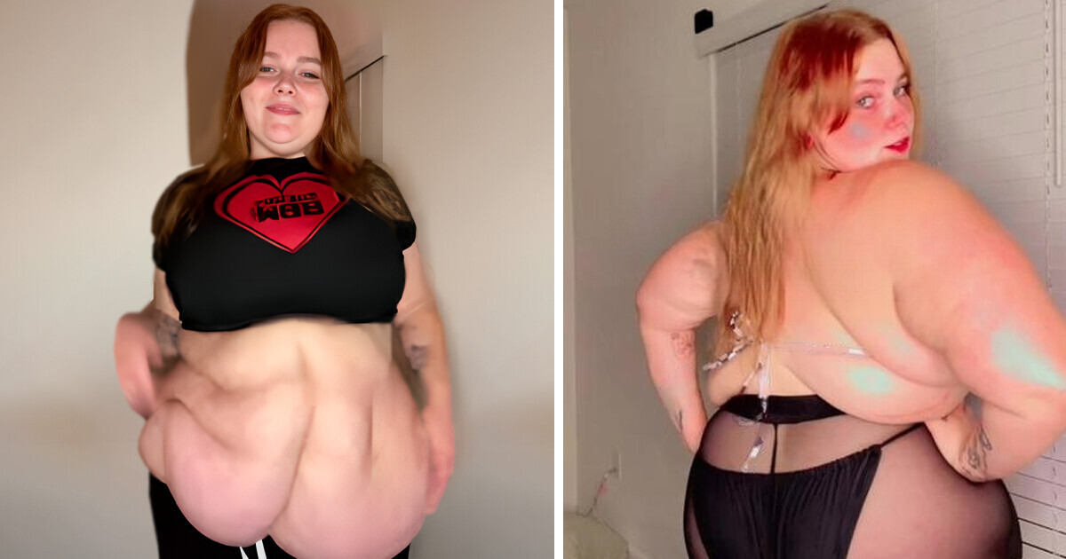Exibindo excesso de pele, mulher questiona padrões de beleza e inspira reflexão Exibindo excesso de pele, mulher questiona padrões de beleza e inspira reflexão