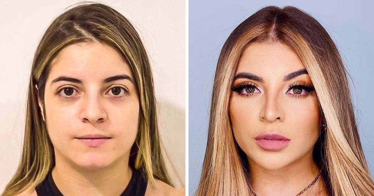 10+ Famosas que assumiram ter “corrigido” algo que as incomodavam no rosto e não se arrependem de nada