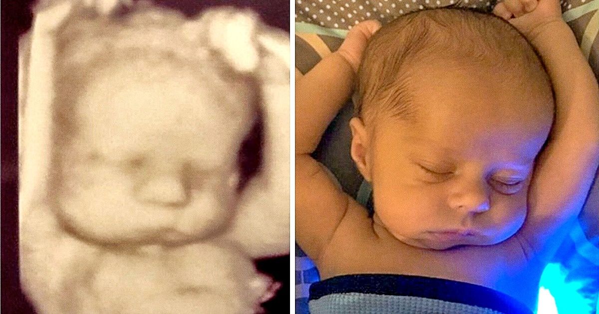 17+ Fotos curiosas de antes e depois