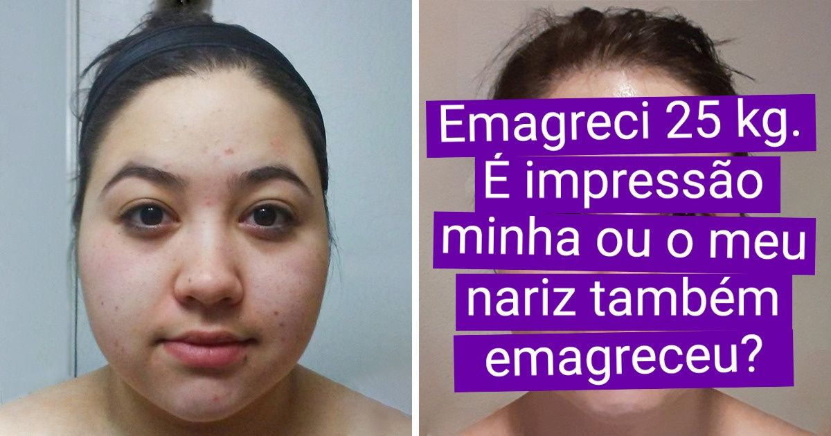 19 Fotos de “antes e depois” que mostram o progresso em sua forma mais pura 19 Fotos de “antes e depois” que mostram o progresso em sua forma mais pura
