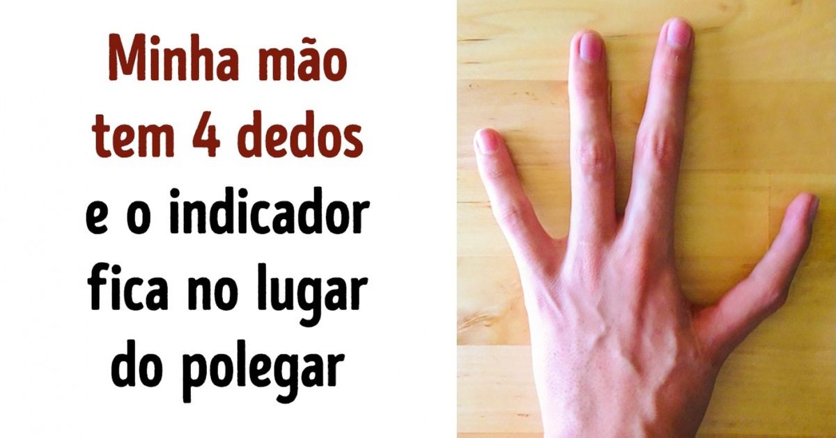 24 Imagens que você precisa ver antes de morrer