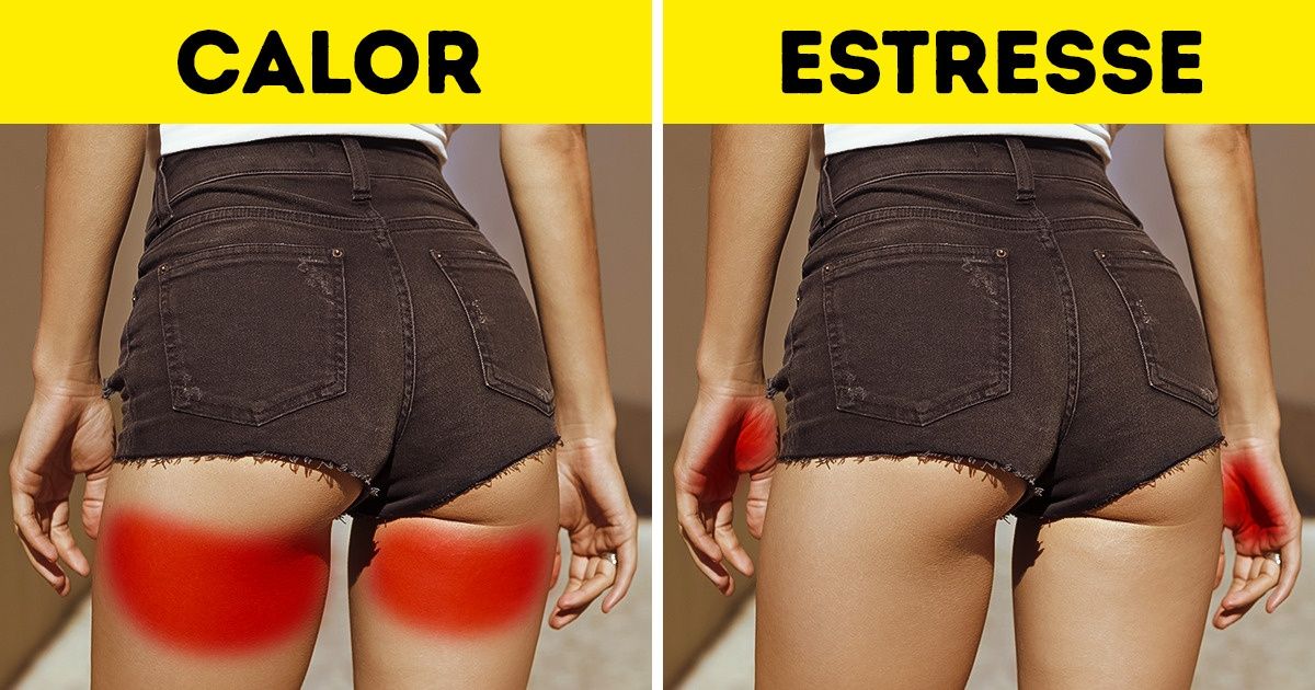 8 Problemas que se escondem por trás do mau cheiro corporal 8 Problemas que se escondem por trás do mau cheiro corporal