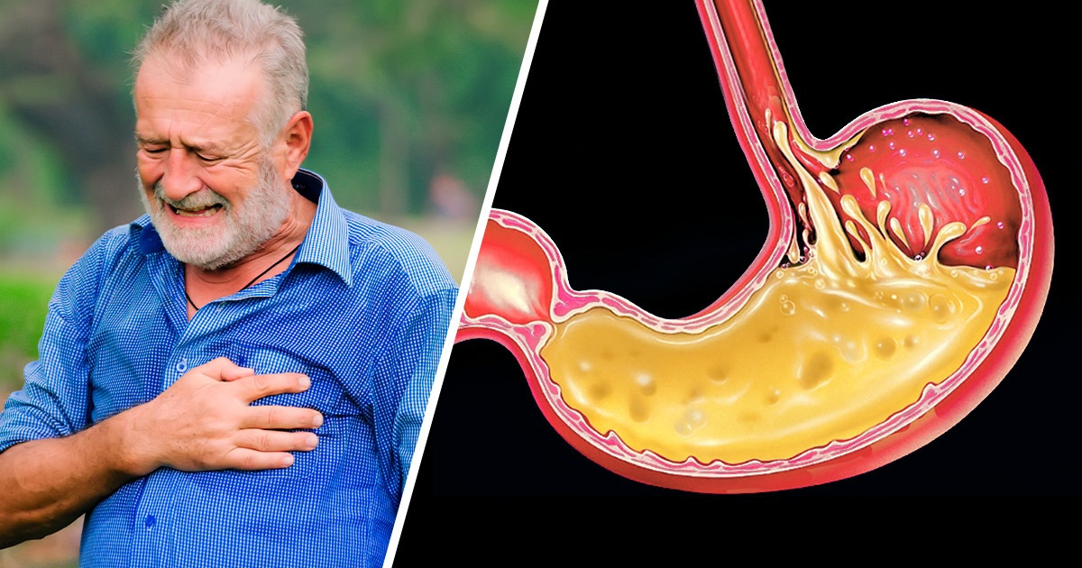 10+ Alimentos ácidos que o seu corpo pode odiar se você os consumir