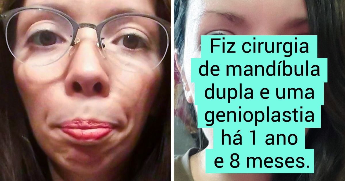 19 Internautas que não tiveram medo de mudar a aparência e ficaram ainda mais belos