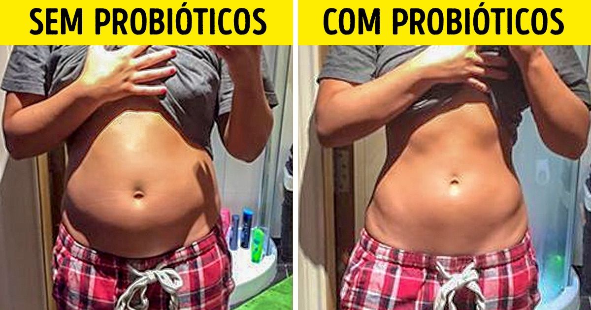 Como os probióticos podem melhorar sua saúde e onde obtê-los (spoiler: iogurte não é a única fonte)
