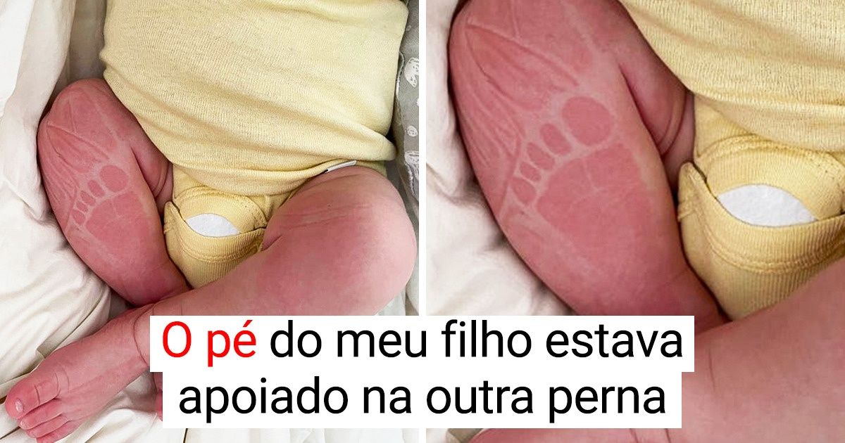 17 Fotos para aquecer um pouco os nossos corações
