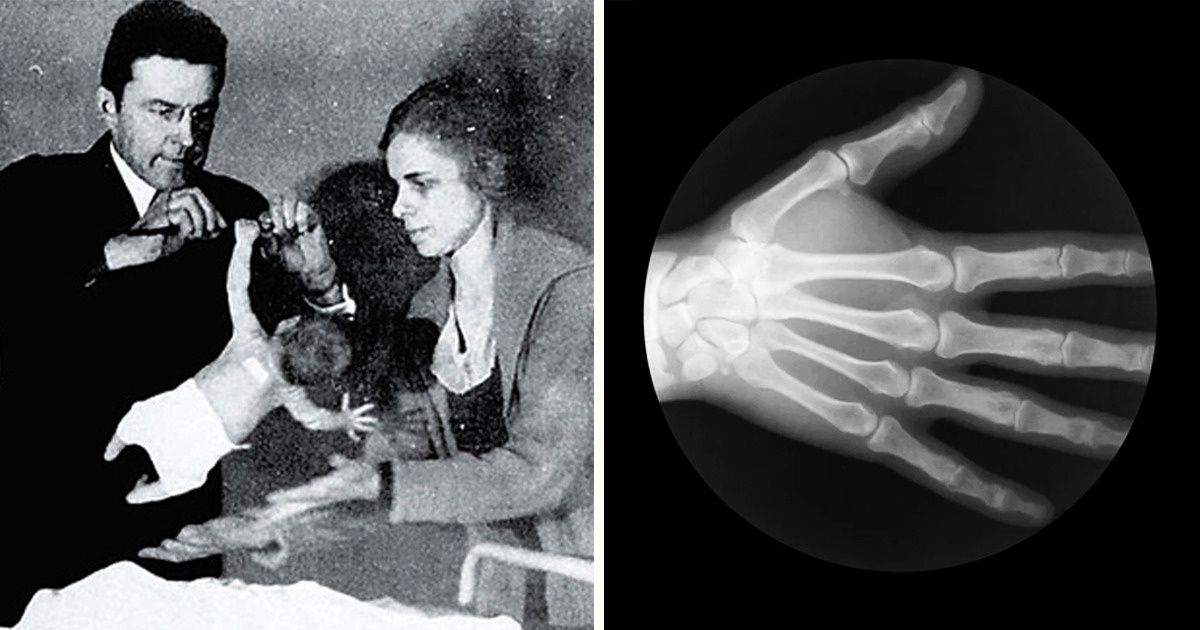 10 Coisas que mostram que nosso corpo é o sistema mais misterioso do mundo 10 Coisas que mostram que nosso corpo é o sistema mais misterioso do mundo